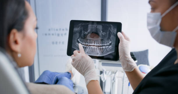 Licensed Tooth Extraction service in Charleston, SC - Smile Center Dentistry
